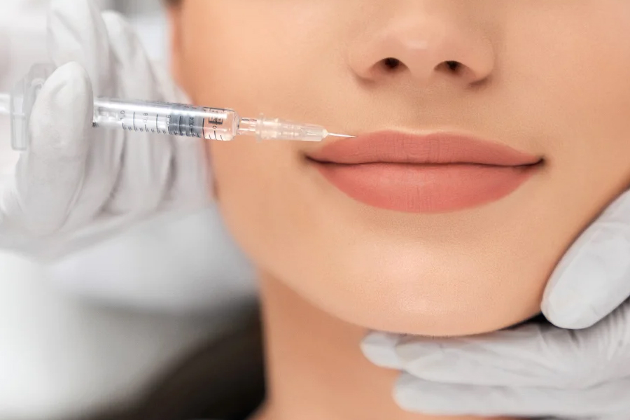 How To Cope With Changes After Lip Fillers